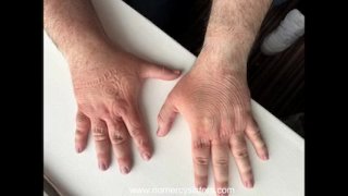 Sisters arm and hand trampling